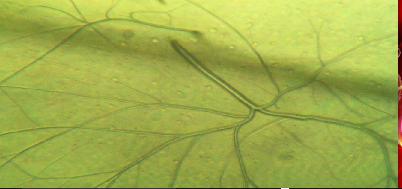 chironomus